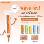Strataderm gel ของแท้ 100% Exp.2026 ซิลิโคน เจล ทา รักษาแผลเป็น แผลนูน คีรอยด์ ผ่าตัด ศัลยกรรม รอยดำ หลุมสิว