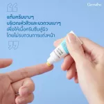 ครีมแต้มสิว แอคทีฟ ยัง &โลชั่นแต้มสิว แอคทีฟ ยัง  ครีมและโลชั่นแต้มสิว  สิวหนุ่ม สิวสาว หน้ามันเป็นสิว วัยรุ่นเป็นสิว สิวหัวใหญ่ หน้ามัน ครีมแต้มสิว