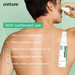 Oxecure Body Acne Spray สเปรย์สำหรับสิวที่หลัง สิวยุบเร็ว 50ml