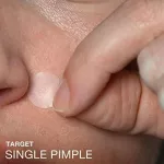 แผ่นแปะสิว นูโทรจีนา Stubborn Acne Ultra-Thin Blemish Patches (Neutrogena®) Acne Pimple Patch