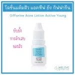 Active acne, Giffarine Acne Lotion Active Young, relieve inflammation of acne (10 grams).