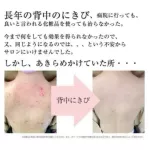 ของแท้100%>>สเปรย์พ่นสิวที่หลัง Kobayashi Sena cure spray 100ml senacure senakyu