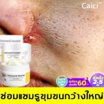 Caici Moisturizer Absorbed well into the skin Solve dry skin problems Add deep moisture Revealing soft skin, skin cream, white face cream