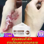 See the results clearly, the scars are all gone, the cream reduced the scar, reducing the burns, burns, scalds. Surgical wound, etc. Scar (scar removal cream Gel to reduce scars Acne reduction cream)