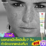 This freckles are very good. Aichun, blemish cream, dark spots, tinea, sunblaza and others. Cream to reduce melasma Thick blemish cream Inhibit melanin, etc. Flass cream, face cream