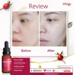 Trilogy Certified Organic Rosehip Oil 45 ml