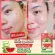 SISTAR OFFICIAL Watermelon Gel-freckles serum Radish serum Clear face loan set
