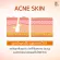 Acne wounds, acne, acne, reduce acne, clear face, fine face - C ascorbic serum - Youngger Impress - 5 g. Get 2 pieces CSE x 2