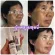 Lalis premium, membrane, membrane, blemish treatment, reduce freckles, dark spots, urgent formulas, rejuvenate the skin to be clear. Do not come back to chronic cream, blemish, especially the sun