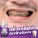 Dentalswitz เดนทัลสวิตช์ เซตฟอกฟันขาว 1แถม1 ยาสีฟันฟอกฟันขาว คราบฟันเหลือง หินปูนกลิ่นปาก เสียวฟัน