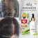 Onagain hair serum เซรั่มลดผมร่วง เพิ่มผมหนา เซรั่มปลูกผม เซรั่มบำรุงผม โดยแพทย์เฉพาะทางด้านเส้นผม Dr.Orn Hair Center