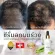 Onagain hair serum เซรั่มลดผมร่วง เพิ่มผมหนา เซรั่มปลูกผม เซรั่มบำรุงผม โดยแพทย์เฉพาะทางด้านเส้นผม Dr.Orn Hair Center