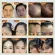 SEONWON Son Won, Korean ginseng shampoo, reduce hair loss, some scalp, reduce gray hair, eliminate dandruff, stimulate the new occurrence.