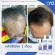 LYO ไลโอ ผลิตภัณฑ์ดูแลเส้นผม ลดผมร่วง  Shampoo แชมพู 1 ขวด  บำรุงเส้นผมและหนังศีรษะ หมดกังวล ผมร่วง ผมบาง By. หนุ่ม กรรชัย