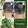 9 types of herbal shampoo, Khundej shampoo, fungus, eczema, tinea, scalp, leather wound
