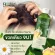 Khun Dej Herbal Shampoo, Reduction of the scarring, scarring, scarring