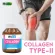 Collagen Type Tybie Collgen Type II Biocap Type 2 -Type Type2 Collagen Type 2 Collagen Type 2 Collagen Type 2 Knee pain
