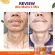 วิตามินซีสด 4 แถม 4 ดีพราวด์ Deproud Bio Vitaminc ดีพราว วิตามิน ผิวขาวใส วิตซีถัง ลดสิว คอลลาเจน กลูต้า ต้านหวัดภูมิแพ้ ส่งฟรี