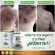 EX, a small gearbox, 30 capsules, strengthening the body's immune system Herbs increase immunity, vitamin EX, reduce allergy, flu, pneumonia, ready to deliver !!