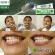 Doctor V ยาสีฟัน ลดเสียวฟัน ยาสีฟันจัดฟัน ดูแลช่องปาก | Doctor V ขนาด 8 กรัม จำนวน 4 หลอด