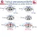 Zebra, stainless steel bowl, bowl, soup, with a lid with a tray used in the zebra hospital, 12 cm, 14 cm and 40.5 cm (SUS 304)