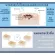 Set, great value, acne or fresh wound. Pressure is lost. Hi-Spot Mint & Hi-Patch.