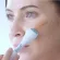 SMOOTH E SCAR SILICONE GEL + SCAR ROLLER - สมูทอีสการ์ซิลิโคนเจล พร้อมสการ์โรลเลอร์