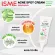 ISME IS has acne cream, acne treatment, acne, acne, acne, sports cream, acne cream, concentrated 10 grams
