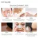 Focallure pimple suction sheet Clean the pores Use the nose area
