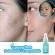 ผิวสะอาด นุ่ม เปล่งปลั่ง - Skinsista V Young Booster 15 ml.แถมฟรี  Vit C Extra Bright Cleansing Gel 100 ml.