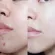 บูสเตอร์เคลียร์สิว - Skinsista V acne clear booster 15ml.