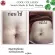 COCORO TOKYO COOL COLLAGEN 5 ML. 4 pieces, stretch marks, stretch stretching, reducing stretch marks Slimming cream Skin problems