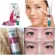 Dark circles under the eye cream, HIMALAYA Under Eye Cream 15ml