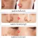 SAY NO and the blemish on the face! Cream, blemish, blemish cream, reduce melasma Inhibits the growth of melanin Makes the skin white, clear, blemish cream, blemish treatment