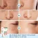 This freckles are very good. Aichun, blemish cream, dark spots, tinea, sunblaza and others. Cream to reduce melasma Thick blemish cream Inhibit melanin, etc. Flass cream, face cream