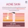 ⚡⚡000youber Impress cosmetic ➕ 2free2! Young Youngger Serum Baby Serum, Acne reduction, Wrinkles, Serum, Clear face ➕ Get 4 pieces at a special price (YS X 4).