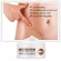 See the results clearly, the scars are all gone, the cream reduced the scar, reducing the burns, burns, scalds. Surgical wound, etc. Scar (scar removal cream Gel to reduce scars Acne reduction cream)