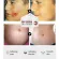 See the results clearly, the scars are all gone, the cream reduced the scar, reducing the burns, burns, scalds. Surgical wound, etc. Scar (scar removal cream Gel to reduce scars Acne reduction cream)
