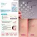Just stick acne, acne, acne, Olive Young 102, the most popular now.