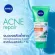 [Free delivery] NIVEA Acne Care, 400ml acne, 90ml. Clear serum 7 ml and serum reduces acne 15 ml.