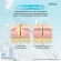 Zermix Acne Pro Cleansing 1000 ml, face washing gel for clogged acne and rash acne. Facial cleansing foam, oily face washing gel