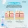[Double pack] Zermix Acne Pro Cleansing 120 ml Facial cleansing gel for clogged acne and inflammation Facial cleansing foam, oily face washing gel