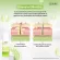 [Pack 3 pieces] Zermix Acne Foam 100 ml, whipped foam For acne and acne, easy to allergic Facial cleansing foam, whipped foam, white face washing foam