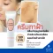 Blemish cream, dark spots, reduce dark spots from blemishes for the face. Giffarine Giffarine Cream Giffarine