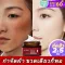 ครีมทาฝ้า ครีมทาฝ้ากระ ครีมแก้ฝ้า ครีมหน้าขาว ครีมทาหน้าขาว ครีมกำจัดฝ้า ครีมขจัดฝ้า ครีมไวท์เทนนิ่ง กระ ลบจุดด่างดำ ครีมรักษาฝ้ากะ