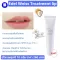 Lip balm, dark lips Special lip lip Sensitive mouth skin SPF15 PA +++ Eddal White Lip Treatment SPF 15 PA +++